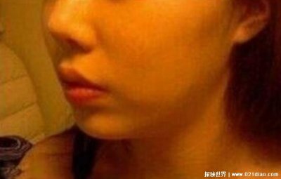 ​最丑的鼻子图片大全 什么样的鼻子丑