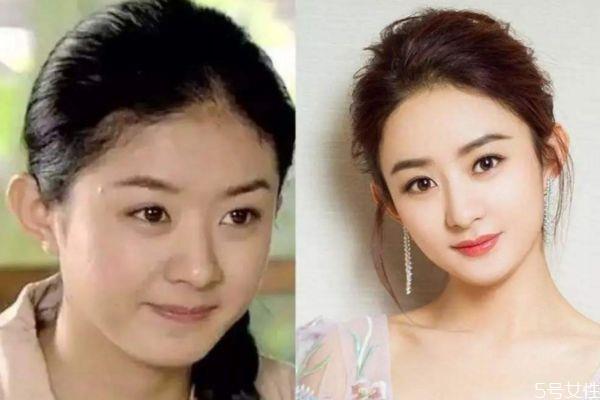 额头发际线高怎么办 这么做告别大额头