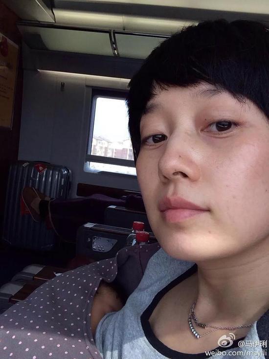 马伊琍又晒素颜照，也不再亮眼。没钱救治，</p><p style=