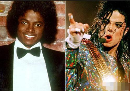 迈克尔杰克逊到底是怎么变白的?这里告诉你真相