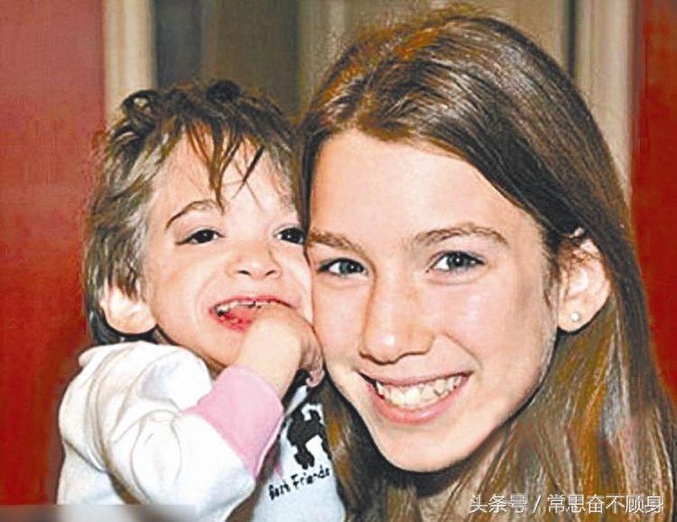 她被称为不老女婴，20岁年纪容貌却像婴儿一样