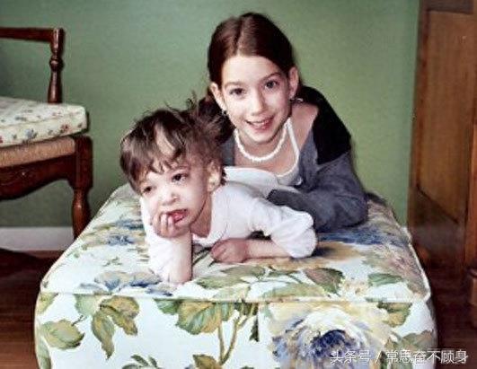 她被称为不老女婴，20岁年纪容貌却像婴儿一样