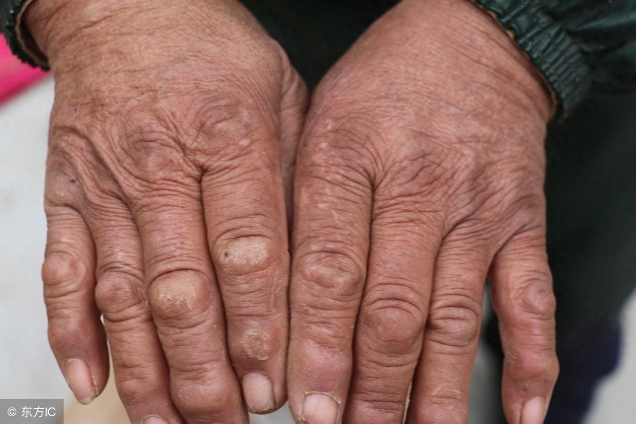 6张长满老茧的手的图片，诉说着生活的境遇，哪个让你热泪盈眶？