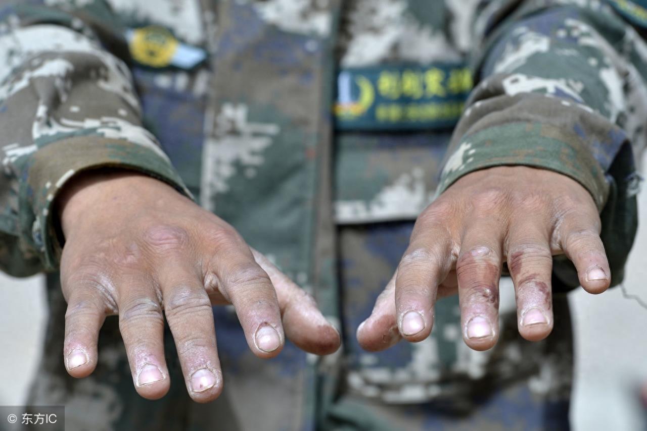 6张长满老茧的手的图片，诉说着生活的境遇，哪个让你热泪盈眶？