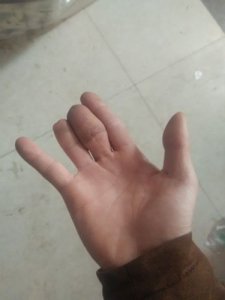 ​右手无名指戴戒指代表什么(右手无名指疼痛什么原因)